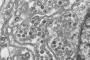 World Health Organization says it will investigate patent on deadly Saudi Arabian virus World Health Organization says it will investigate patent on deadly Saudi Arabian virus