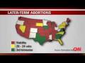 What is a late term abortion? What is a late term abortion?